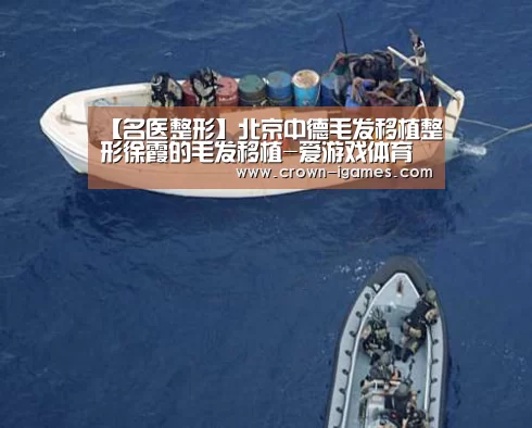 【名医整形】北京中德毛发移植整形徐霞的毛发移植-爱游戏体育下载(图1)