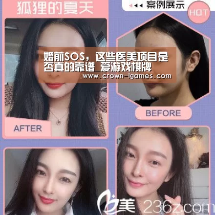 婚前SOS，这些医美项目是否真的靠谱_爱